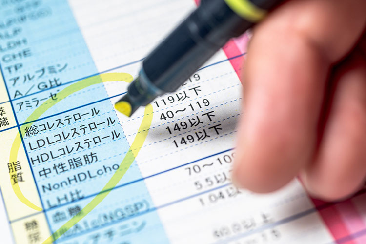 脂質異常症のイメージ画像