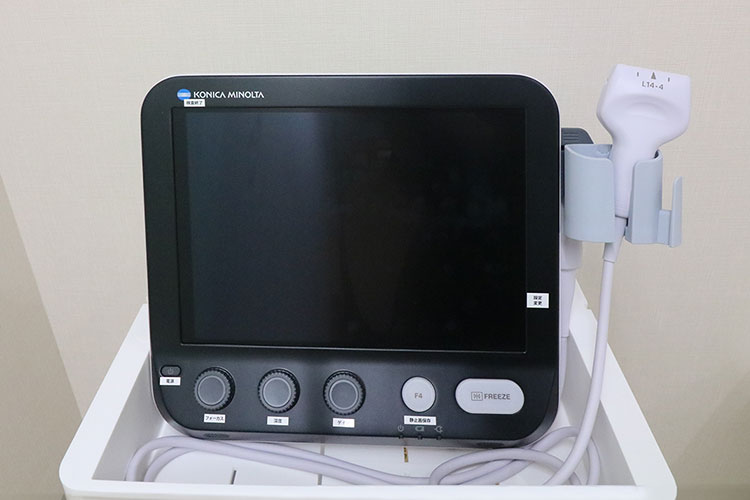 超音波診断装置